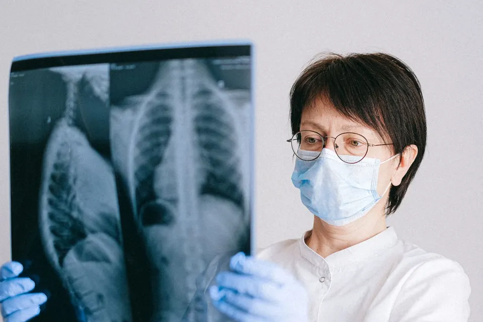Doctor in a mask reviewing an X-ray film